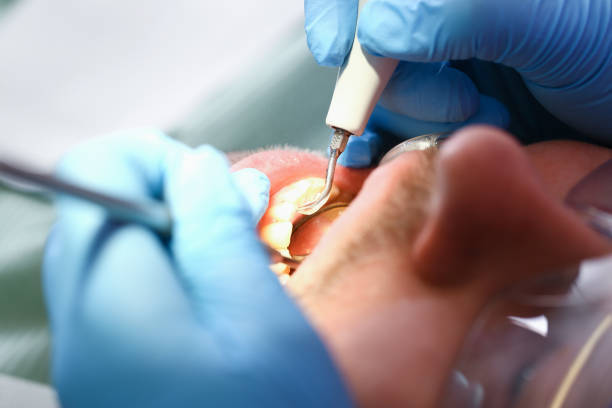 Best Emergency Cosmetic Dentistry in Platte City, MO