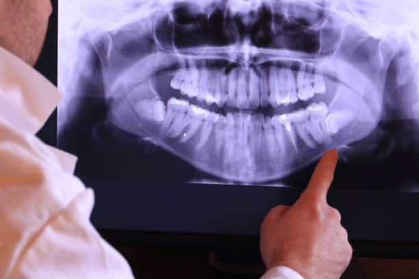 Best Emergency Dentist for Knocked-Out Tooth in Platte City, MO