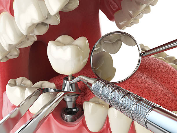 Best Emergency Dental Services for Seniors in Platte City, MO