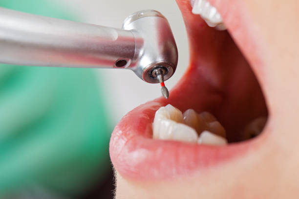 Best Emergency Cosmetic Dentistry in Platte City, MO